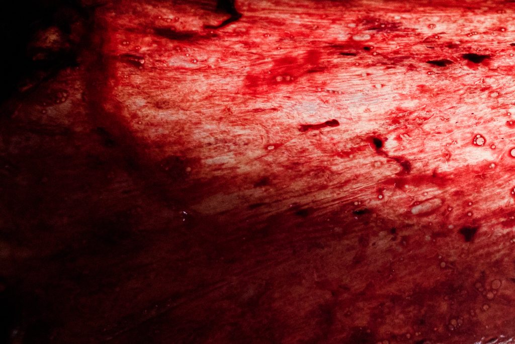 foto detalhe de uma placenta no pós parto imediato, foto de monique olive